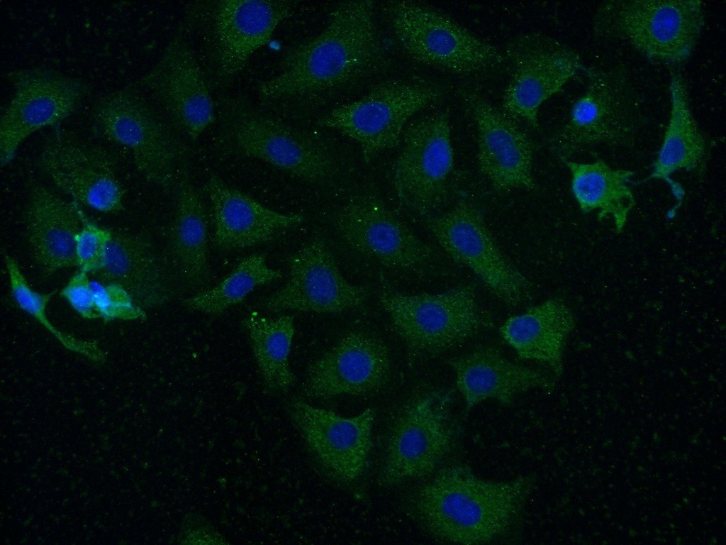 CAMK2 Polyclonal antibody