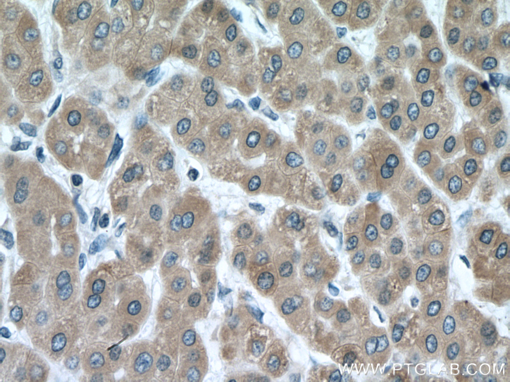 CYP3A5 Polyclonal antibody