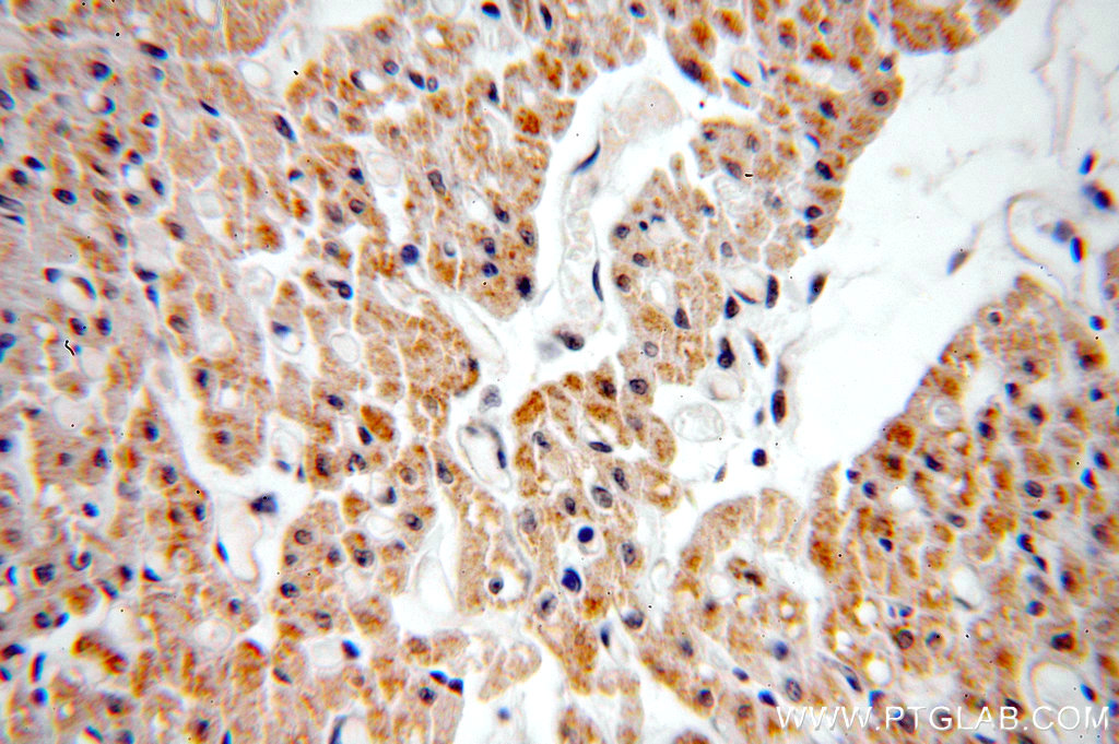 CUL7 Polyclonal antibody