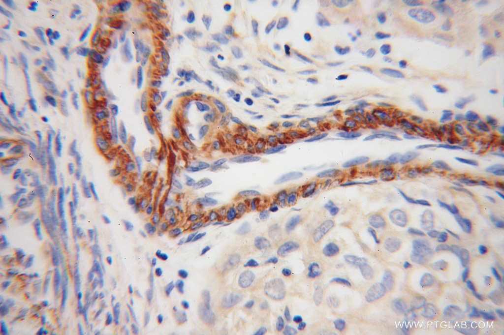 TPM4 Polyclonal antibody