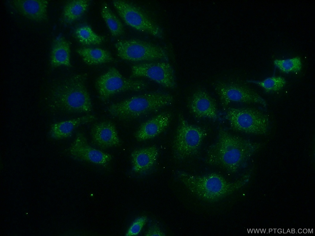 MTG1 Polyclonal antibody