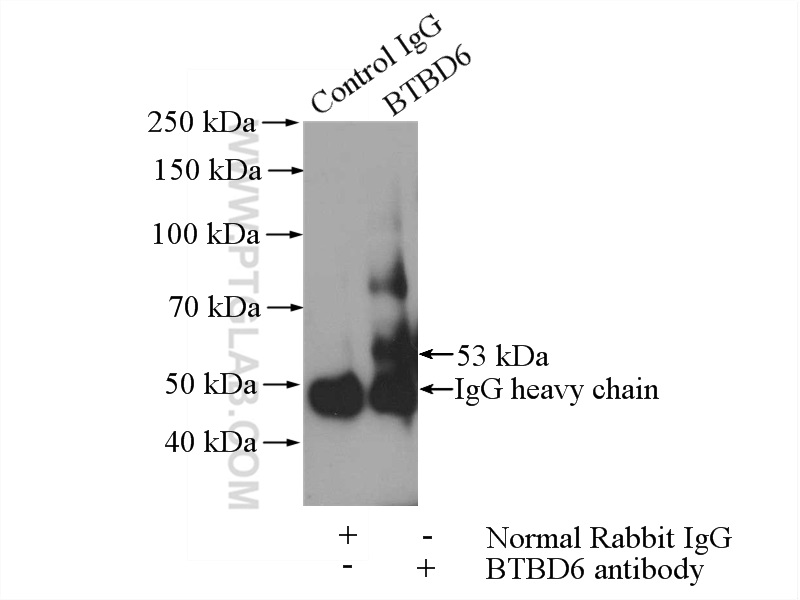 BTBD6 Polyclonal antibody