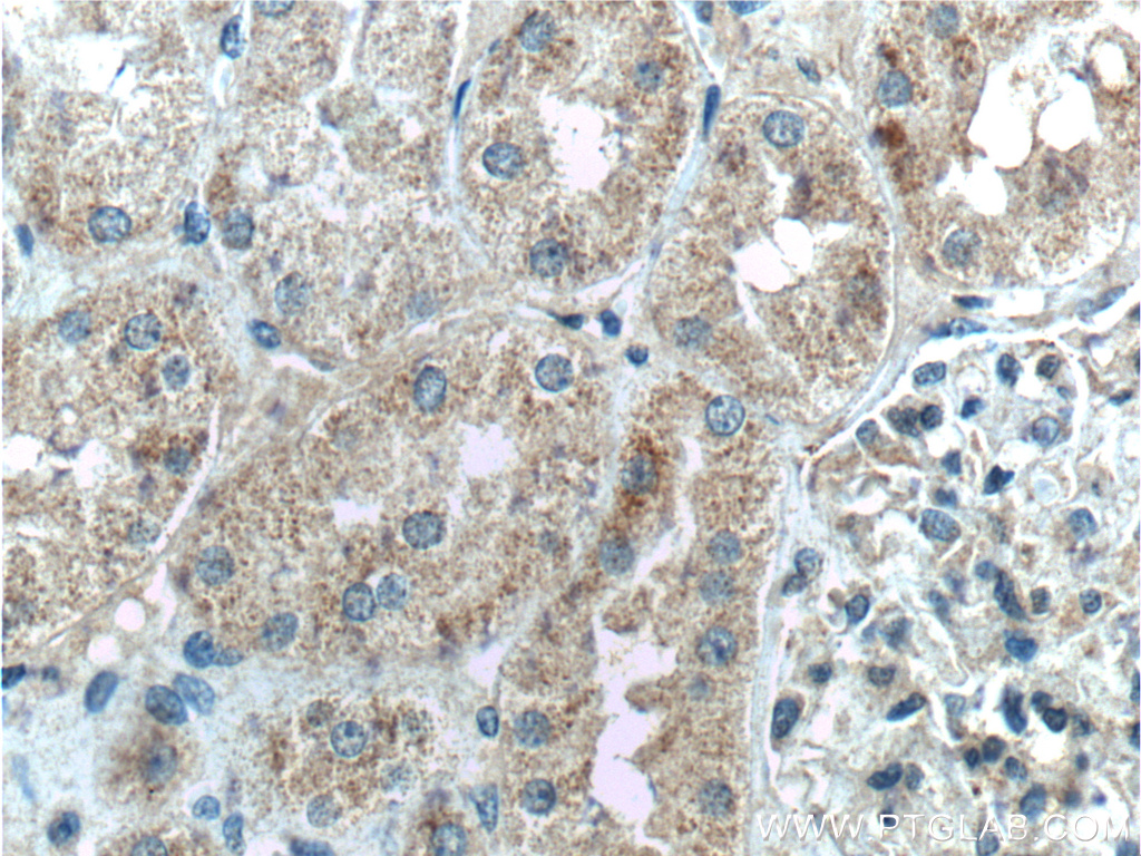 TSLP Polyclonal antibody