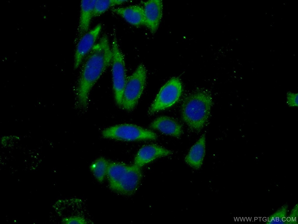 DZIP1 Polyclonal antibody