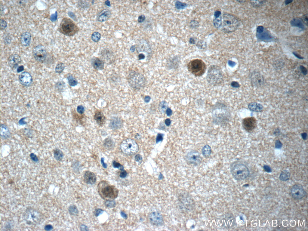 FGF12 Polyclonal antibody