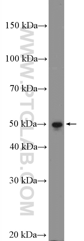 WBSCR16 Polyclonal antibody