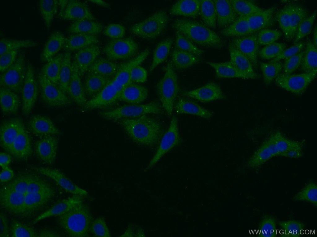 Pentraxin 3 Polyclonal antibody
