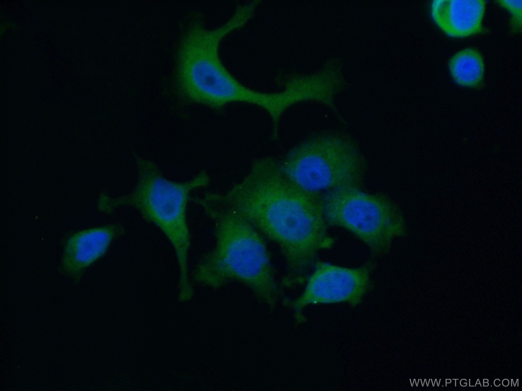 AACS Polyclonal antibody