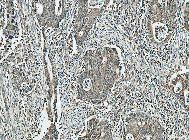 SLC7A6 Polyclonal antibody