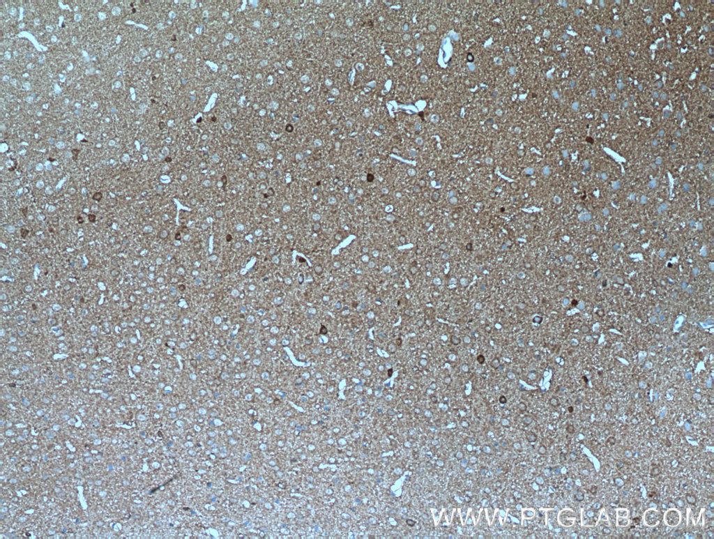 ATP6V0A1 Polyclonal antibody