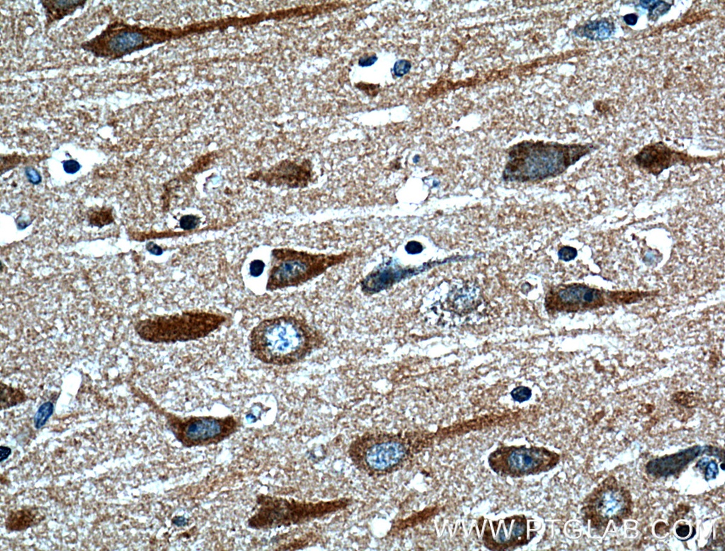 HTR7 Polyclonal antibody