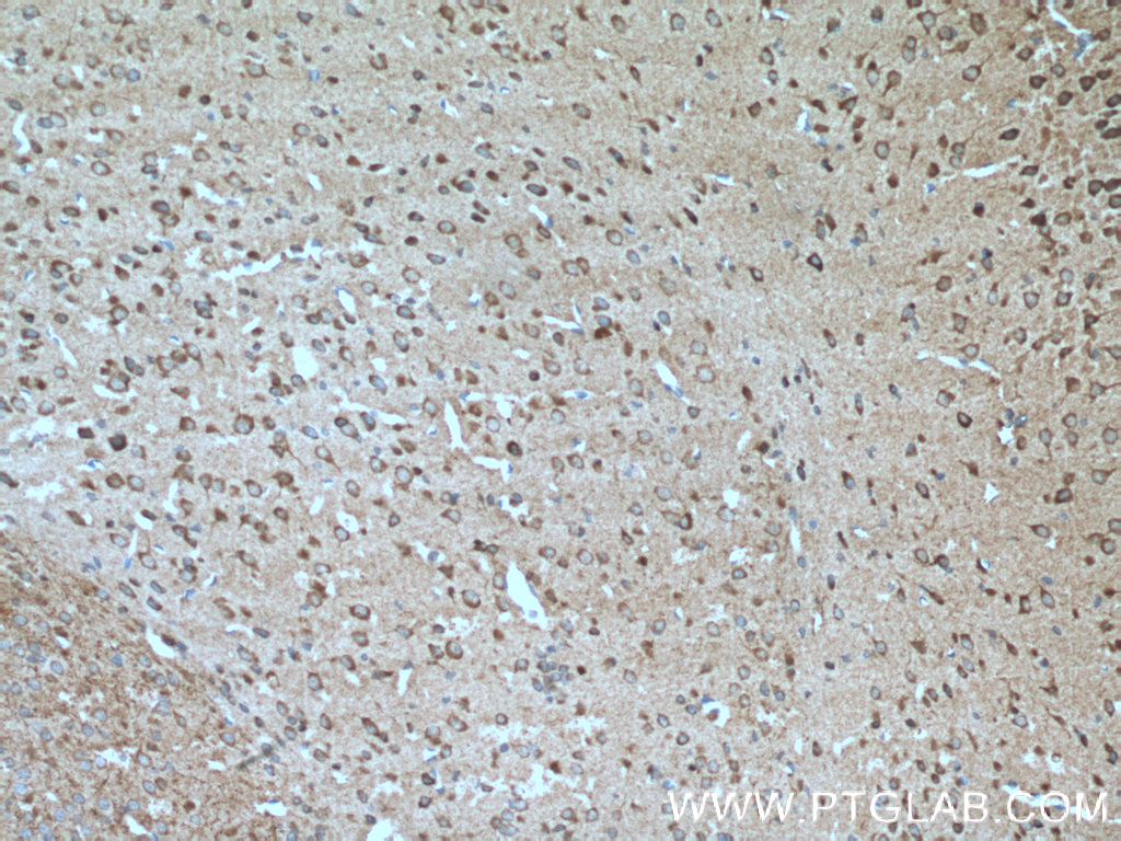 TAC1 Polyclonal antibody