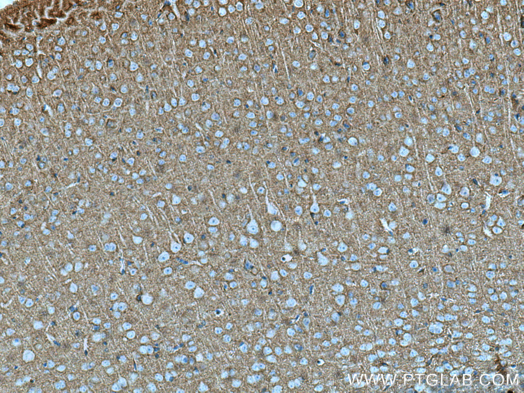 CNTN1 Polyclonal antibody