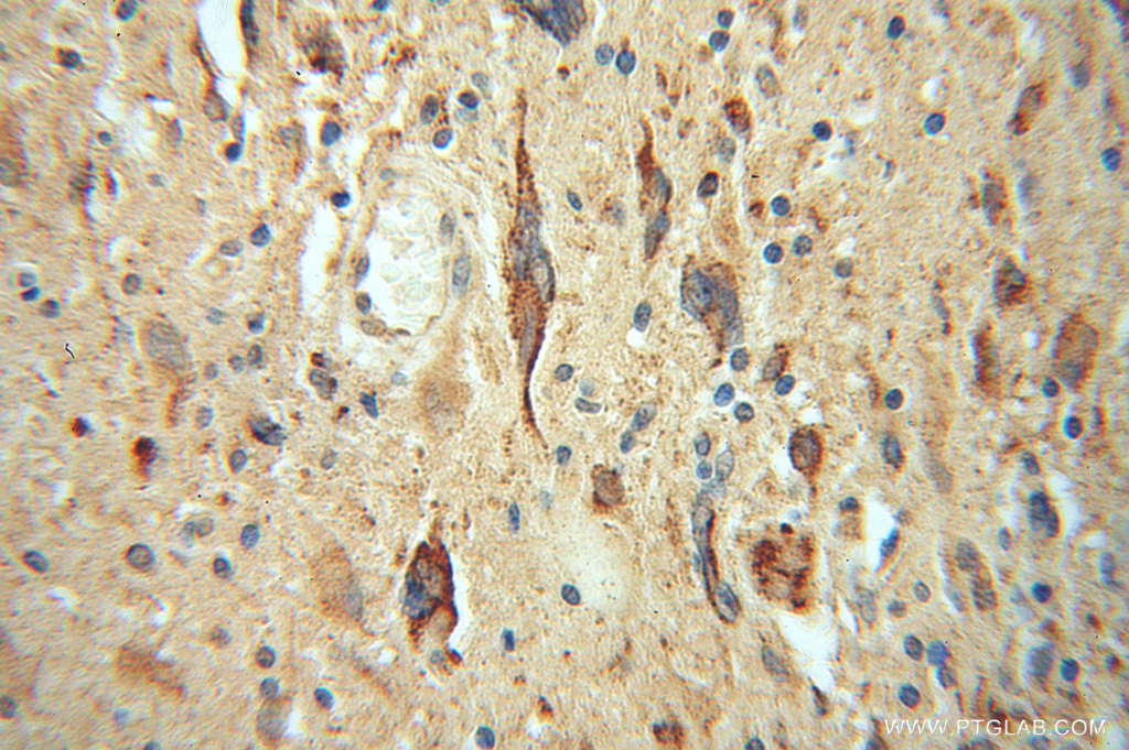 LRRC4C Polyclonal antibody
