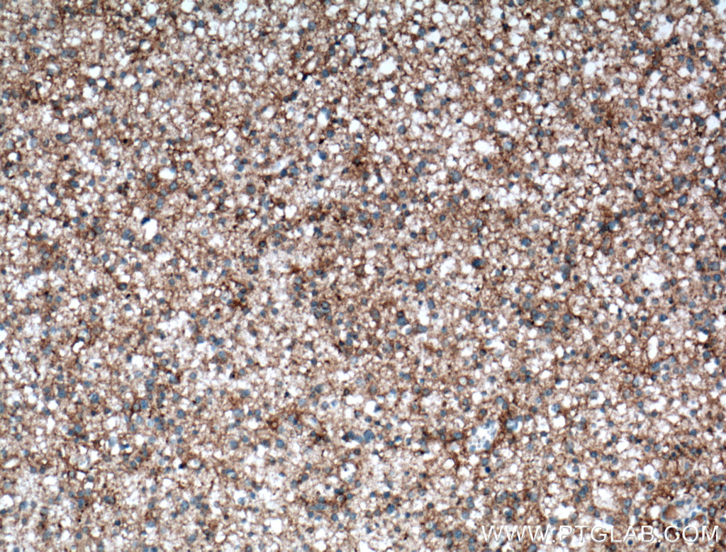 NCAM2 Polyclonal antibody