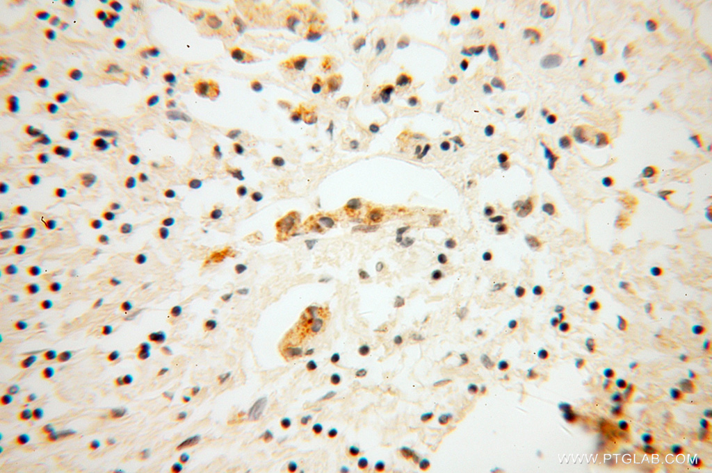 DNAJC4 Polyclonal antibody