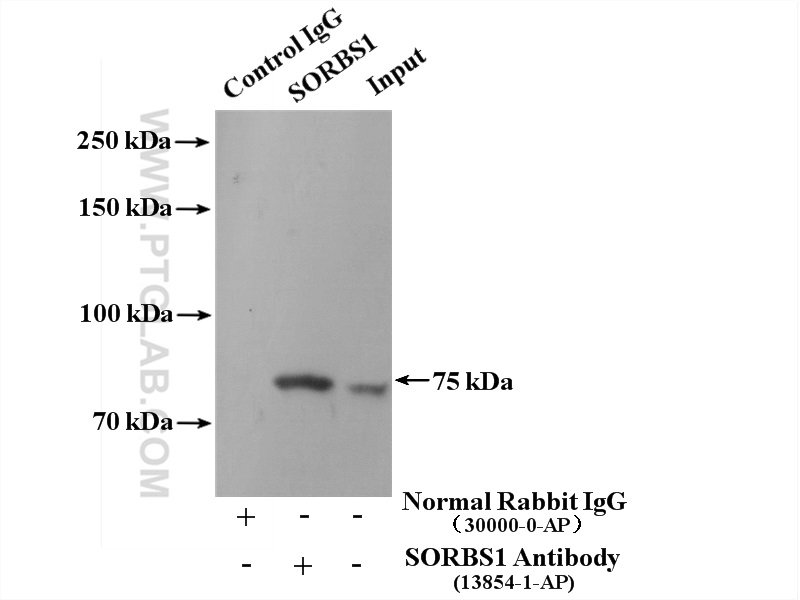 SORBS1 Polyclonal antibody
