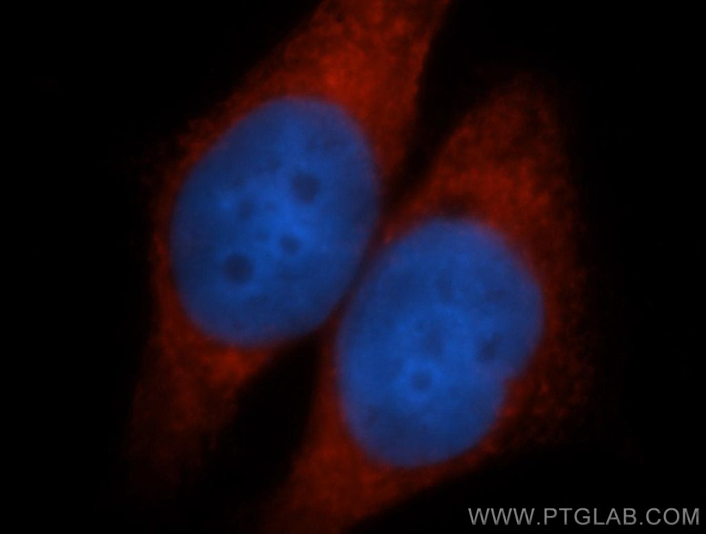 AEG-1/MTDH-Specific Polyclonal antibody