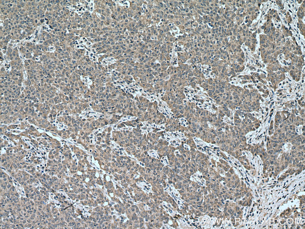 CCPG1 Polyclonal antibody