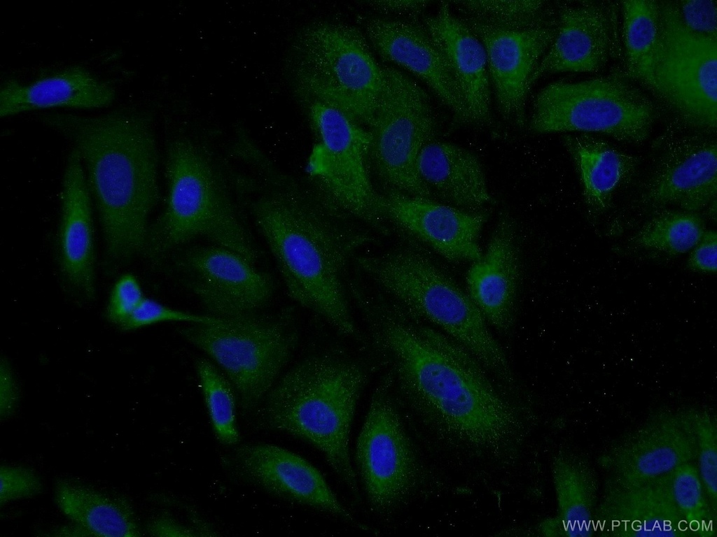 DCP1B Polyclonal antibody