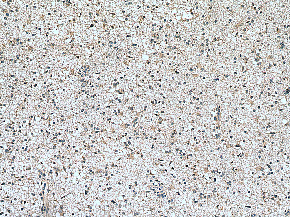 Frizzled 9 Polyclonal antibody