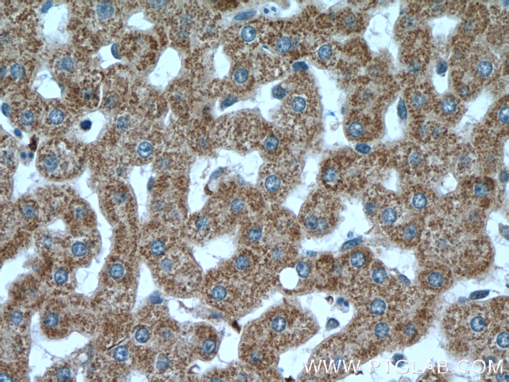 VPS41 Polyclonal antibody