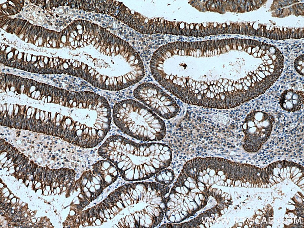 NKCC1 Polyclonal antibody