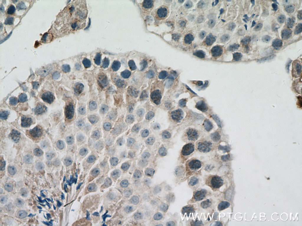 SIAH1 Polyclonal antibody