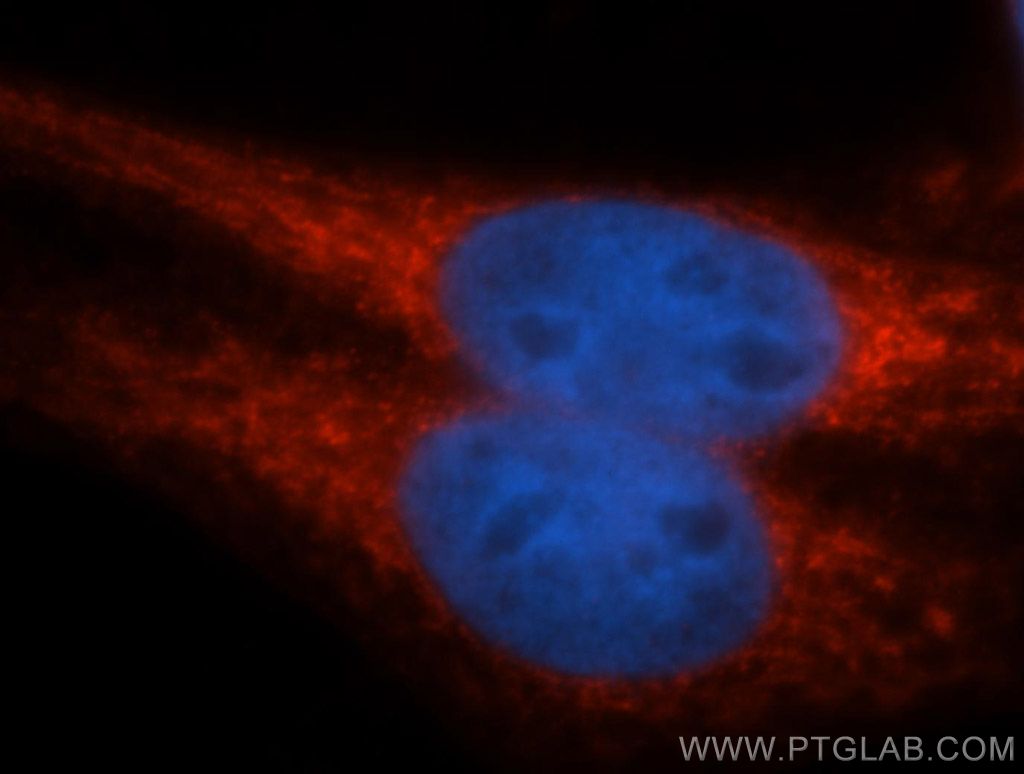 NDUFAF2 Polyclonal antibody