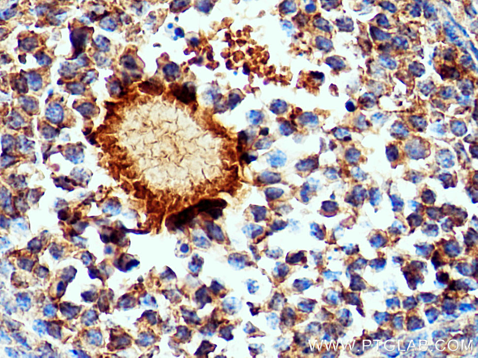 GREM2 Polyclonal antibody