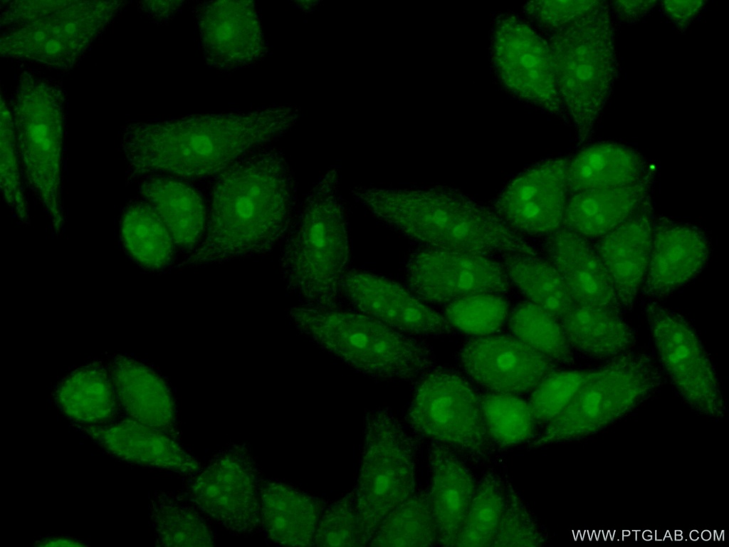 GTPBP4 Polyclonal antibody