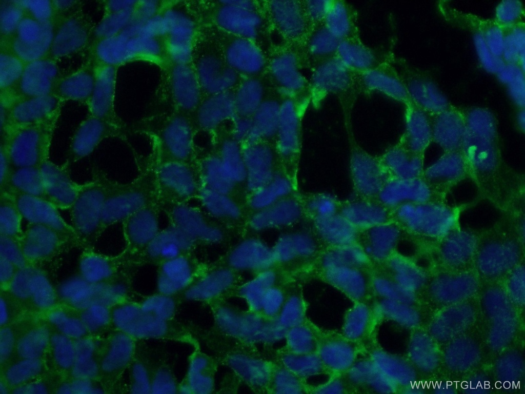 STARD8 Polyclonal antibody