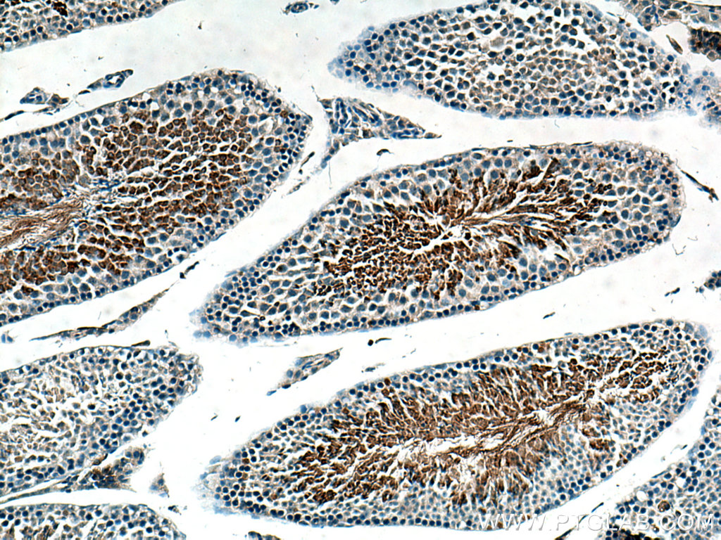 AKAP3 Polyclonal antibody