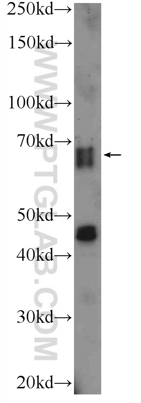 SLAIN2 Polyclonal antibody