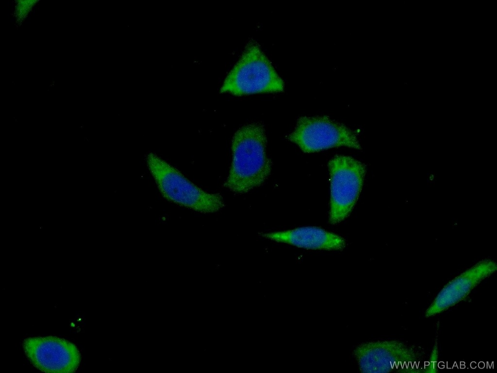 SPAG8 Polyclonal antibody