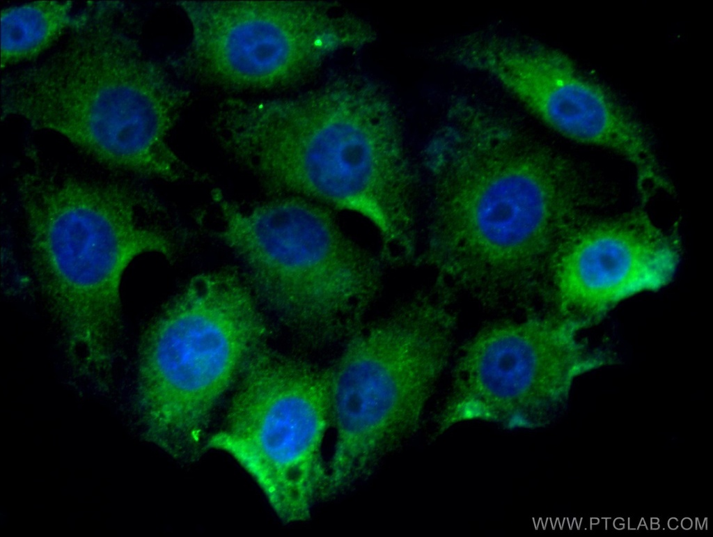 DCX Polyclonal antibody