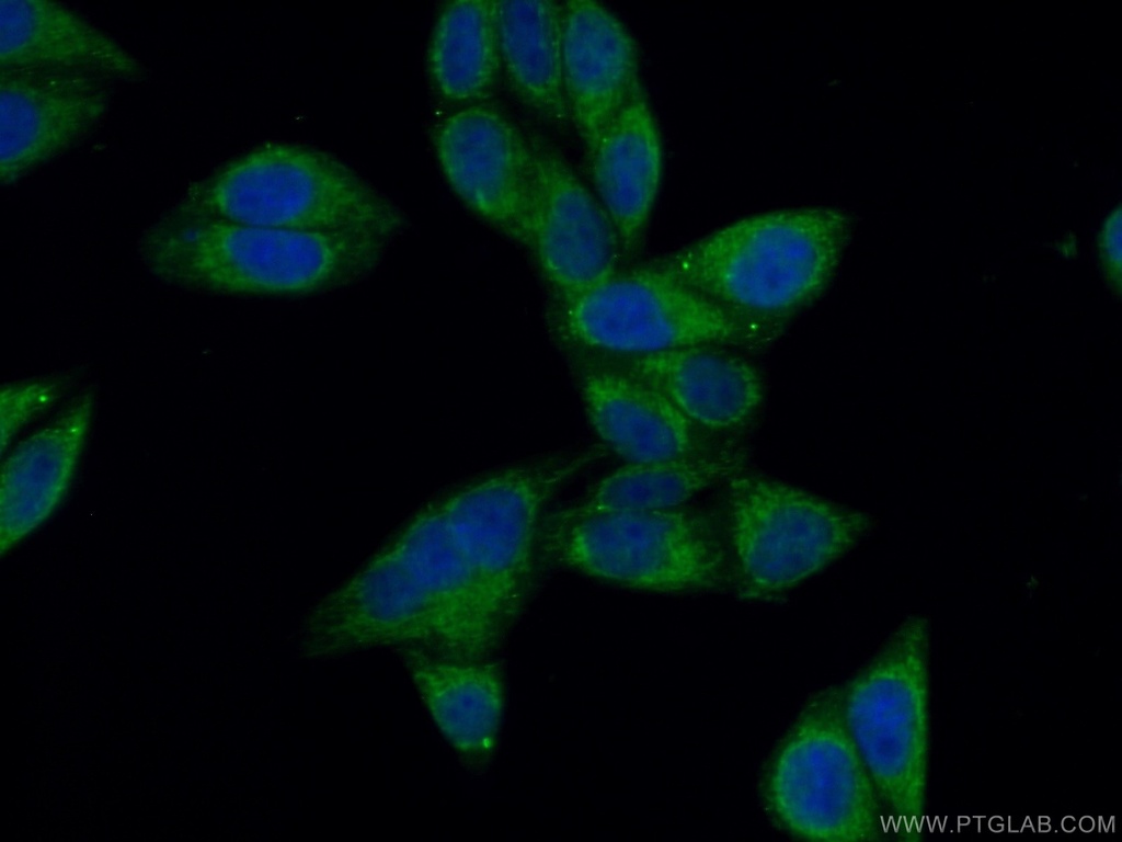 NPC1 Polyclonal antibody
