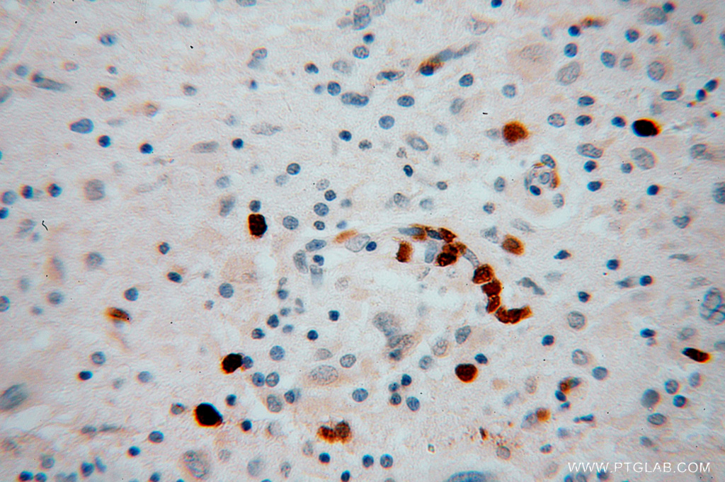 KIF3A Polyclonal antibody