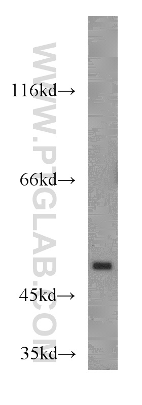 TSPYL1 Polyclonal antibody