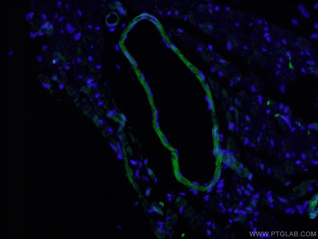 Calponin Polyclonal antibody