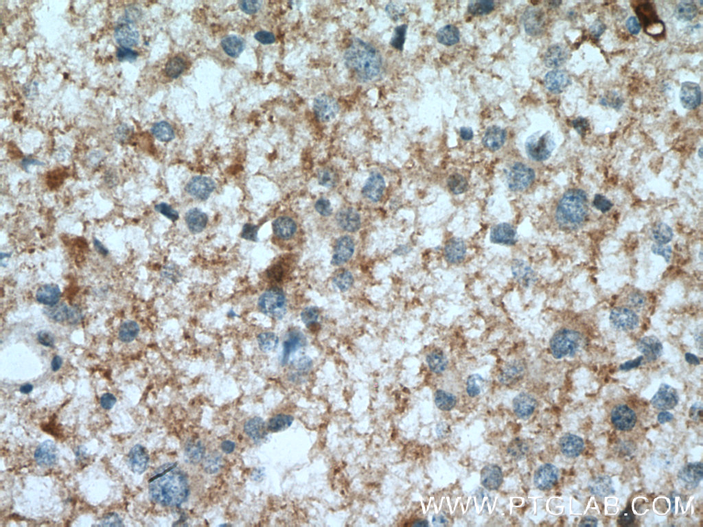 PGM2L1 Polyclonal antibody