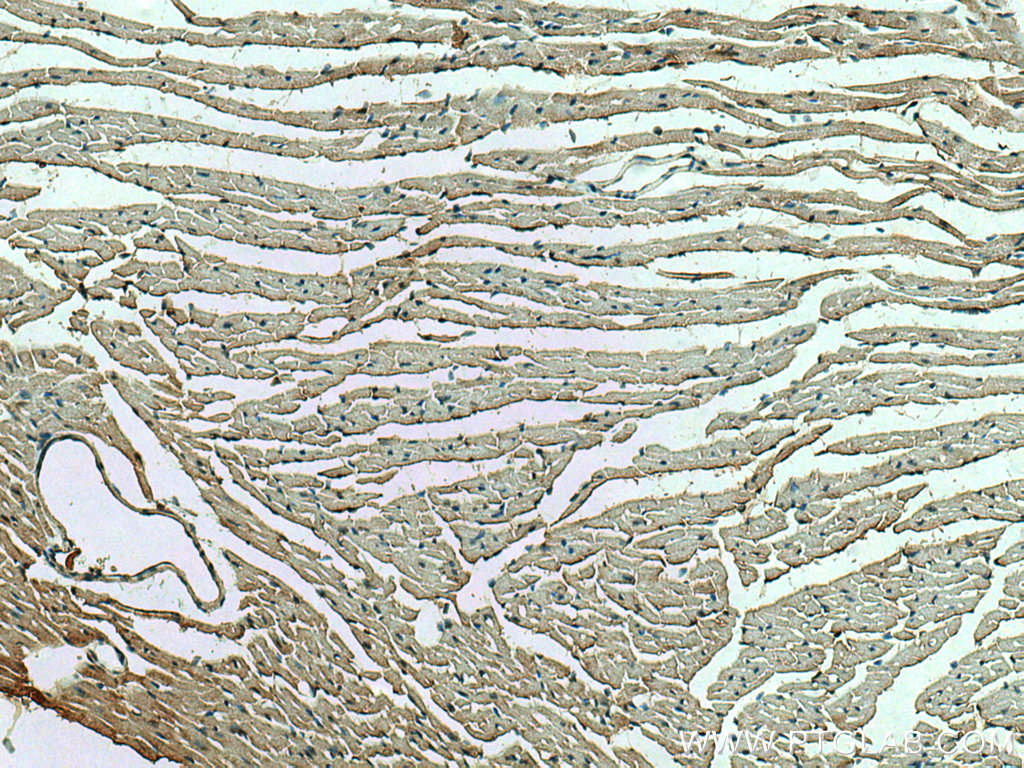 RHOBTB3 Polyclonal antibody