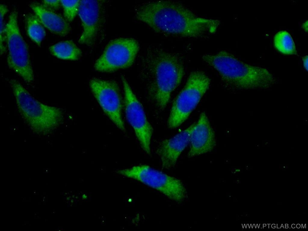 ABCF1 Polyclonal antibody