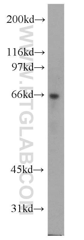 ATE1 Polyclonal antibody