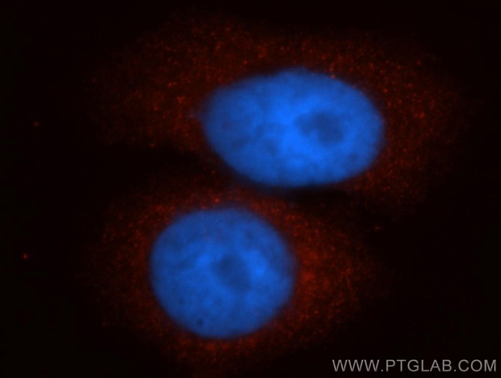 CTNNA3 Polyclonal antibody