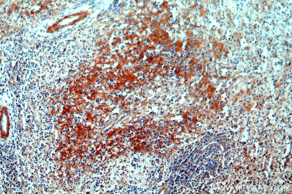CNNM3 Polyclonal antibody