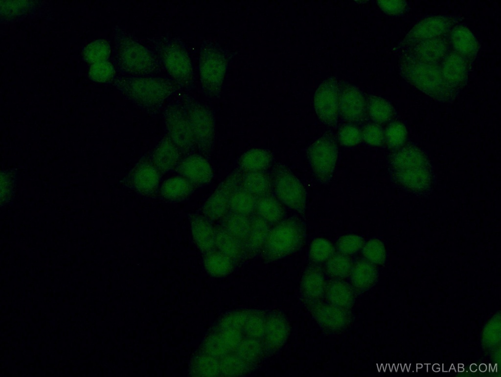 TLK2 Polyclonal antibody