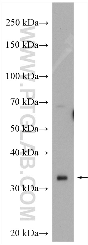 IGFBP1 Polyclonal antibody