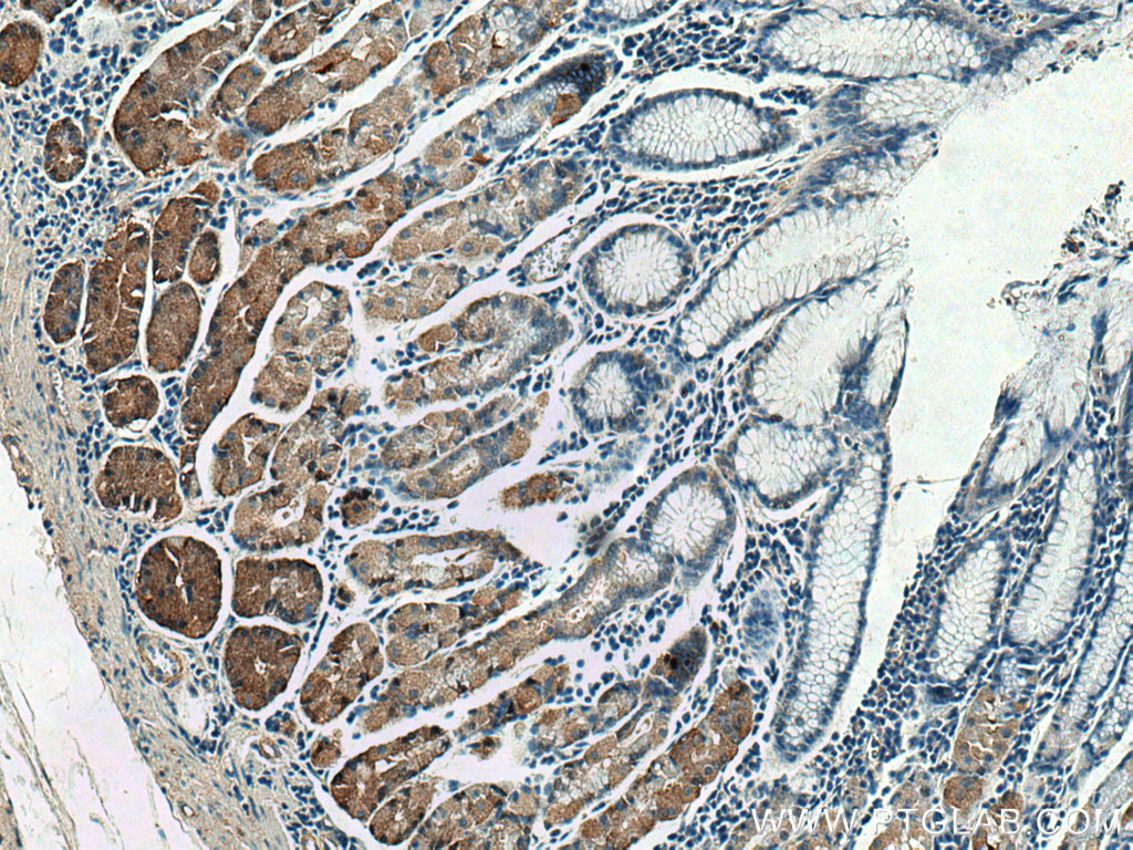 TRAK1 Polyclonal antibody