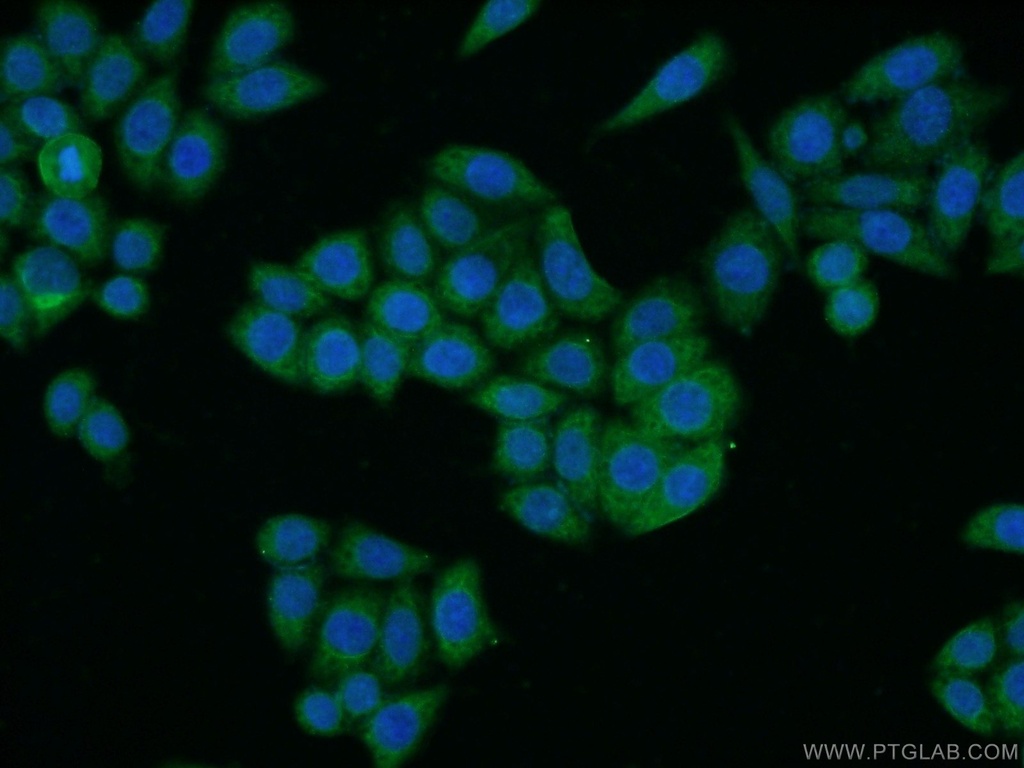 LEFTY2 Polyclonal antibody